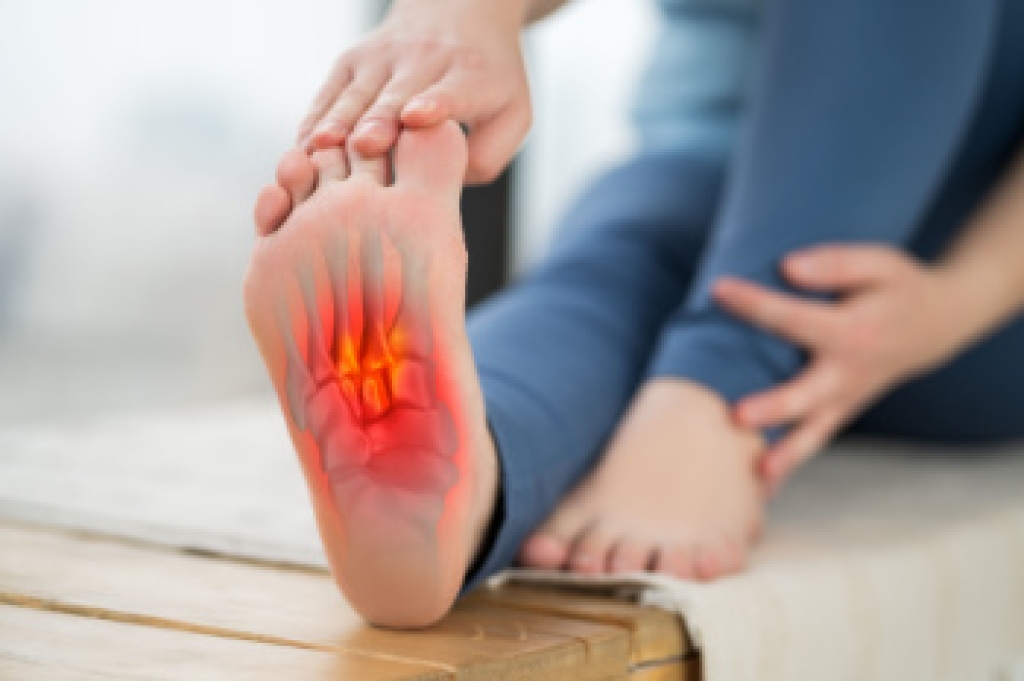 Treating Foot Stress Fractures