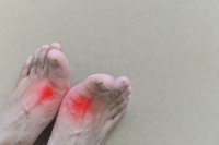 Painful Gout and Possible Prevention Techniques